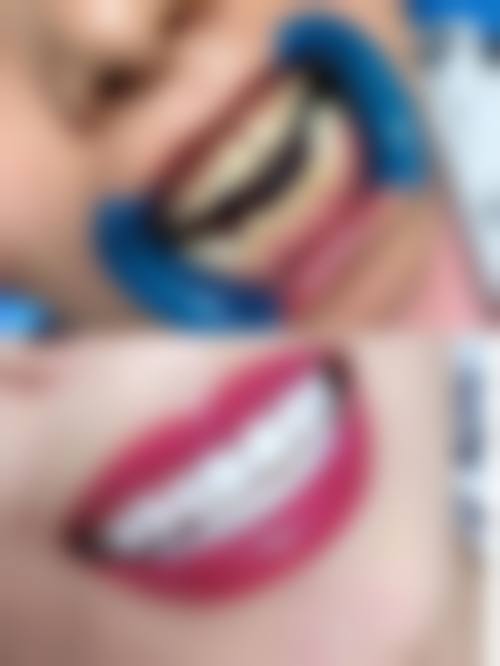 五、深圳正夫口腔(岗厦店)收费价格表