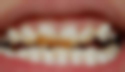 二、南京博韵口腔宋艳医生擅长项目