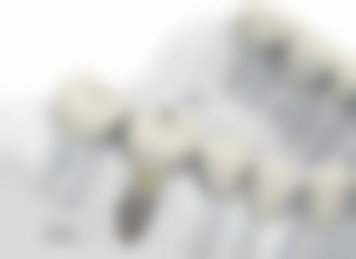 四、大连康贝佳口腔连锁特色项目