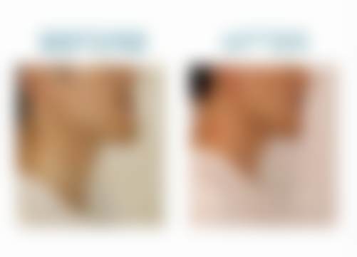 六、北京禾禾口腔张栋梁医生口碑评价及真人实例反馈