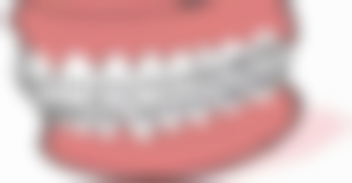 预防烤瓷牙松动的措施