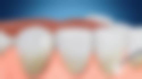 五、宝鸡市金台区好一生口腔诊所收费价格表