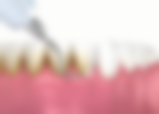 抽了牙神经再做根管治疗痛吗？一般痛感不明显，但受多种因素影响，具体情况因人而异！ 