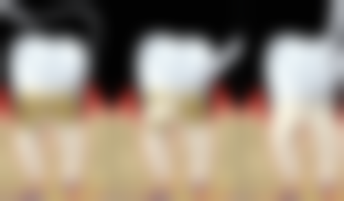 五、大连拜博口腔黄舰医生技术怎么样？