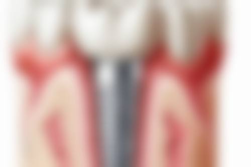 八、广东揭阳牙博士口腔门诊怎么预约？