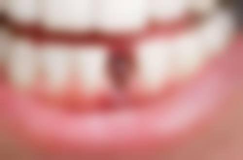 五、齐齐哈尔卓美口腔诊所收费价格表