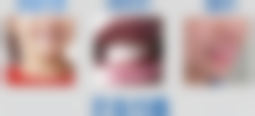 六、上饶维乐阳光徐奂医生口碑评价及真人实例反馈