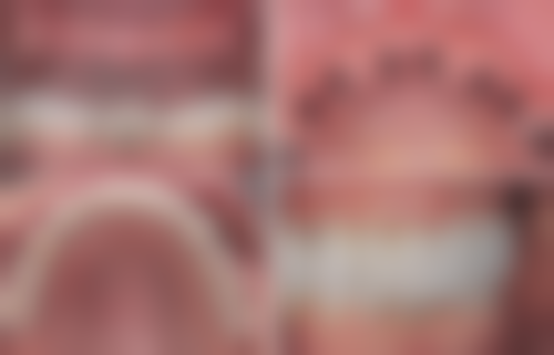 五、湖南娄底邱医师口腔收费价格表