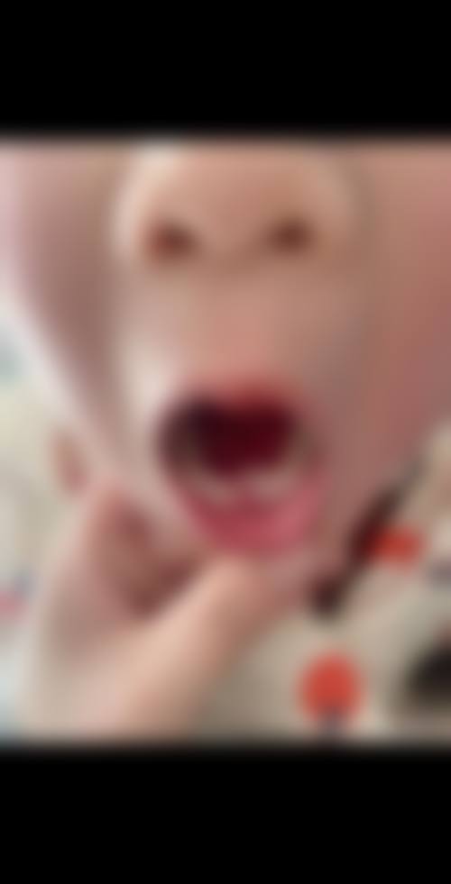 五、福州亚华口腔门诊部收费价格表