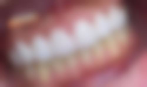 五、岳阳湘阴卓越口腔收费价格表