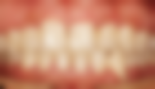 五、北京佳美口腔杜岩医生技术怎么样?