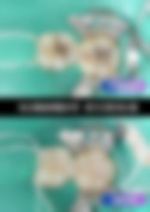 四、宿州砀山县艾唯口腔门诊部特色项目