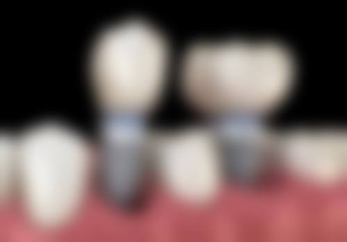 八、江苏常州溧阳杨宝玉口腔怎么预约?