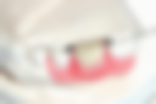 五、大连拜博口腔黄冬梅医生技术怎么样？