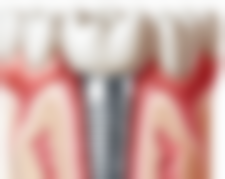 八、温州乐清向华口腔门诊部怎么预约？