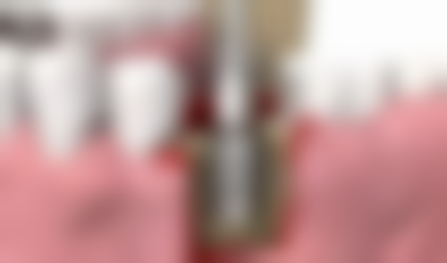 六、重庆天悦口腔口碑如何？