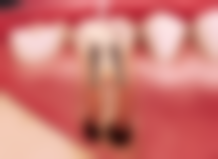 七、成都旭海万震医生怎么预约？