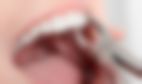 八、西安泰康拜博口腔医院未央门诊部怎么预约?