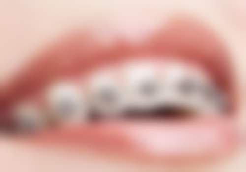 八、广西梧州冬文口腔连锁怎么预约？