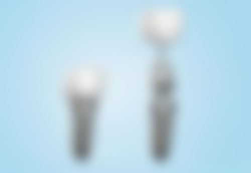 少数情况可暂观