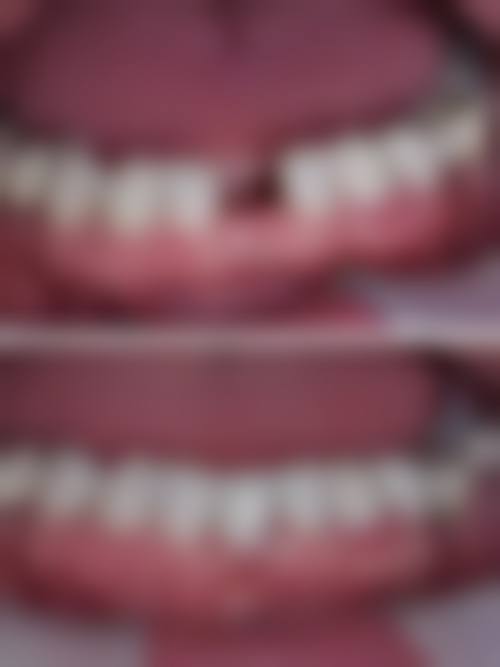 三、山东潍坊坊子晨曦口腔医生介绍