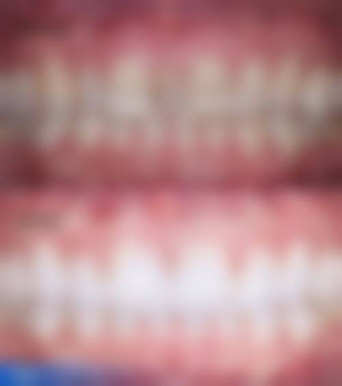 六、山东潍坊坊子晨曦口腔口碑如何？