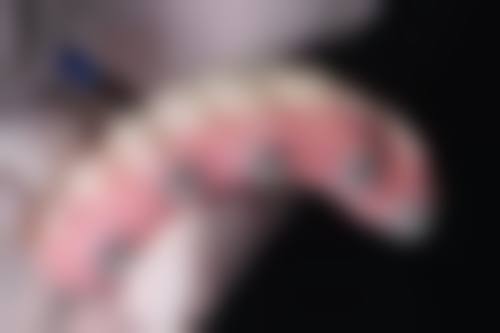 特殊情况对当晚刷牙的影响