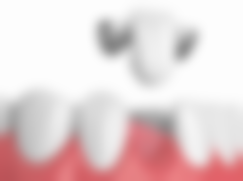 临床通常建议的观察时间