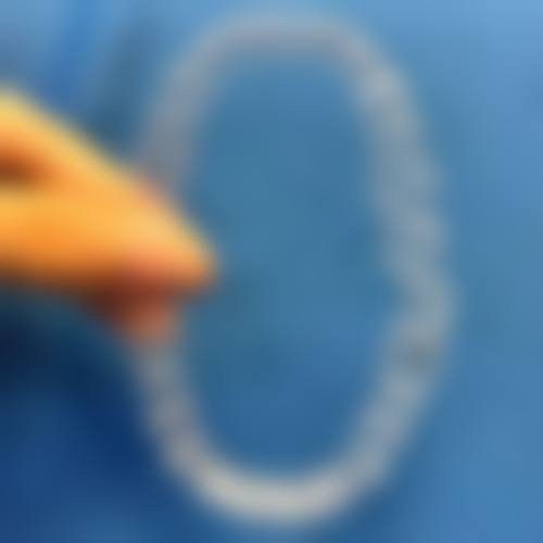 五、德阳口腔程翔医生技术怎么样？