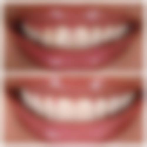 六、忻州市恒伦口腔公园街门诊部口碑如何？