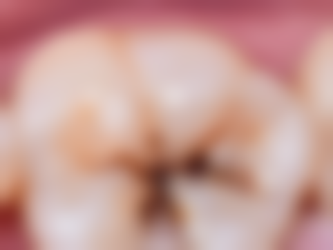 八、咸宁民生中山口腔医院怎么预约？