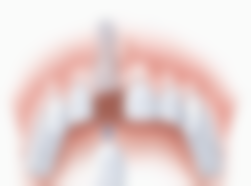 镶牙和种植牙的适用情况区别