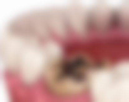 以色列种植牙植体品牌