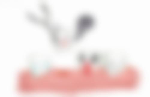 拆除全瓷牙后的后续处理