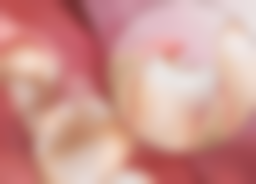 报销流程：轻松搞定补牙费用报销