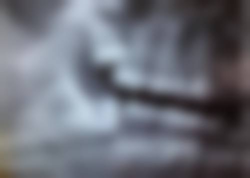 全瓷牙能安全拆除吗？通常可由专业医生安全拆除，但受多因素影响，还有这些要点要注意！ 