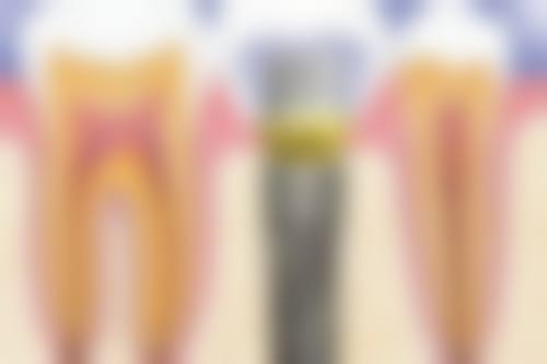 四、江西九江欣康口腔门诊部特色项目