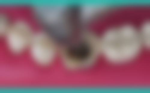 六、江西九江欣康口腔门诊部口碑如何？