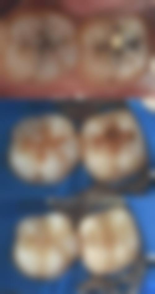 四、济宁保健医院口腔科特色项目