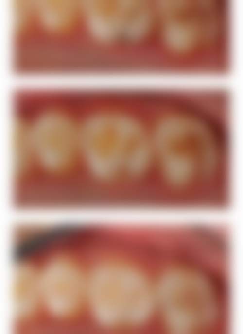 六、北京广渠门内佳美口腔诊所口碑如何?