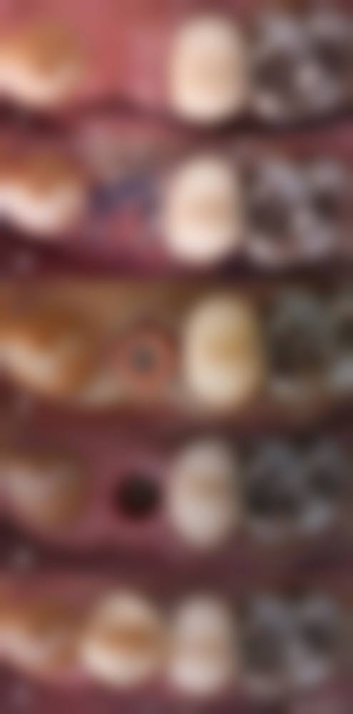 五、杭州美奥口腔(西湖店)收费价格表