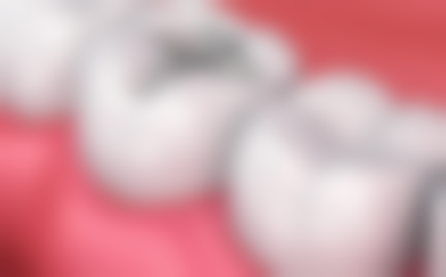 四、汉寿县美伢口腔诊所特色项目