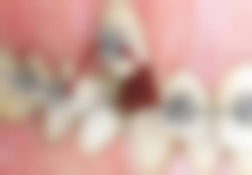 六、合肥佳璟口腔门诊部口碑如何？