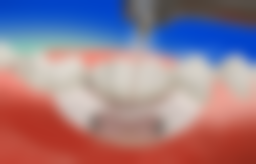 七、大连拜博口腔陈亚超医生怎么预约?