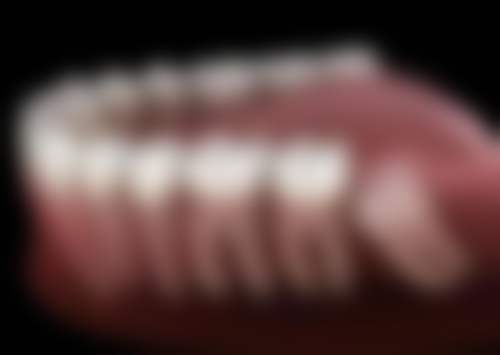 洗牙之后牙齿松动了怎么办？别慌，了解原因与处理措施，做好日常护理很重要！ 