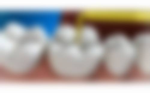 四、四川成都贝沃口腔特色项目