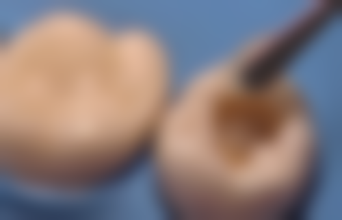 五、常州瑞尔口腔门诊部收费价格表