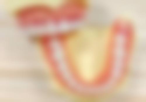 牙齿搬掉了一块怎样补牙？需根据缺损程度选材料，不同修复方式及术后注意事项要知晓！ 