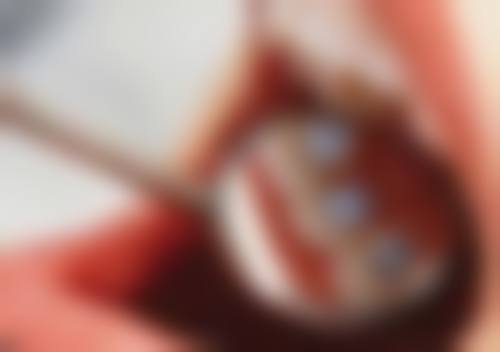 七、福州亚华口腔张勇跃医生怎么预约？