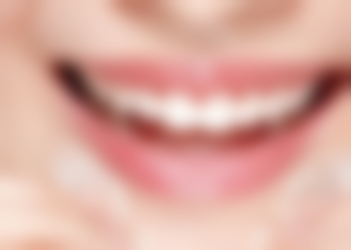 坚持治疗多能改善,积极询问开启矫正之旅